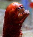 Chestburster